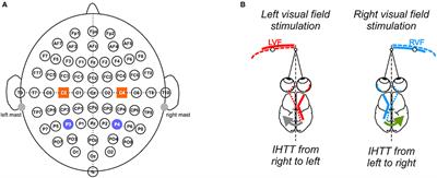 Interhemispheric Transfer Time Asymmetry of Visual Information Depends on Eye Dominance: An Electrophysiological Study